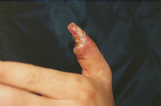 rattlesnake bite pandoras box rattlesnake bite pandoras box