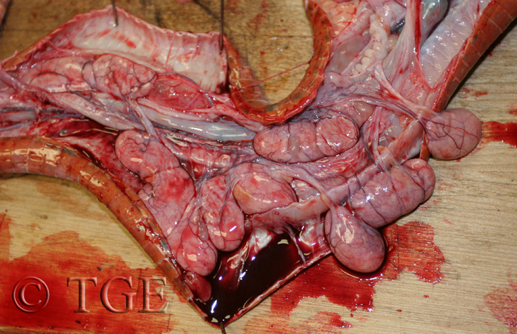 ruptured kidney ruptured kidney